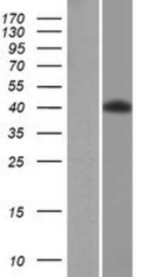 Western Blot: PCYT1B Overexpression Lysate [NBP2-07818]