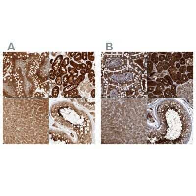 Immunohistochemistry-Paraffin: PCYT2 Antibody [NBP1-83951]