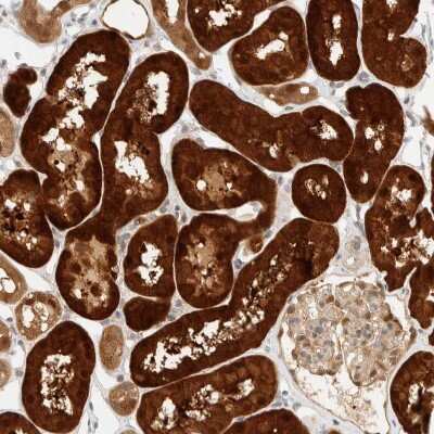 Immunohistochemistry-Paraffin: PCYT2 Antibody [NBP1-83951]