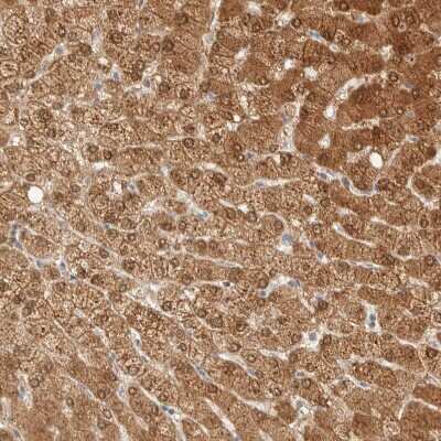Immunohistochemistry-Paraffin: PCYT2 Antibody [NBP1-83951]