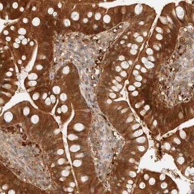 Immunohistochemistry-Paraffin: PCYT2 Antibody [NBP1-83951]