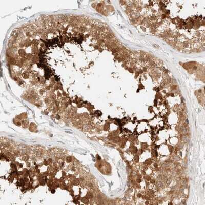 Immunohistochemistry-Paraffin: PCYT2 Antibody [NBP1-83951]