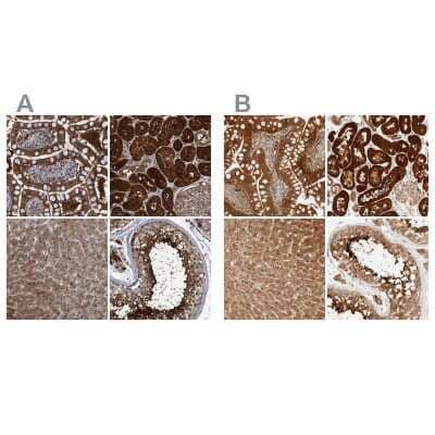 Immunohistochemistry-Paraffin: PCYT2 Antibody [NBP1-83952]