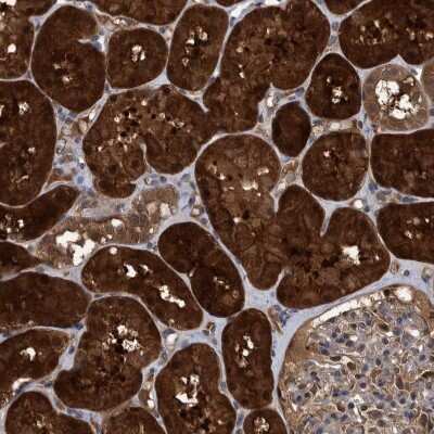 Immunohistochemistry-Paraffin: PCYT2 Antibody [NBP1-83952]