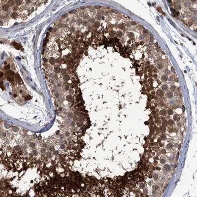 Immunohistochemistry-Paraffin: PCYT2 Antibody [NBP1-83952]