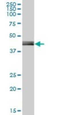 Western Blot: PCYT2 Antibody [H00005833-B01P]