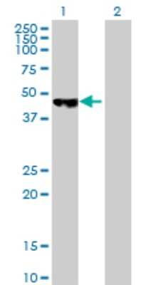 Western Blot: PCYT2 Antibody [H00005833-B01P]