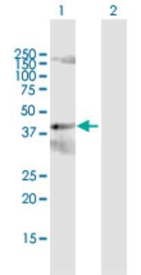 Western Blot: PCYT2 Antibody [H00005833-D01P]