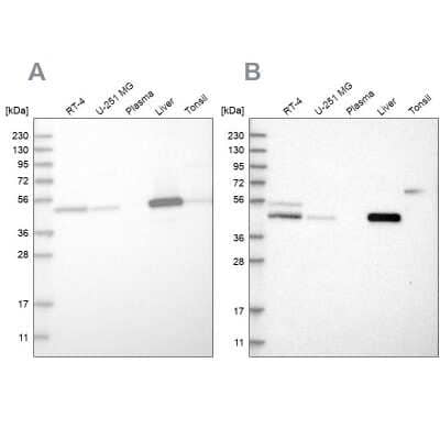 Western Blot: PCYT2 Antibody [NBP1-83951]