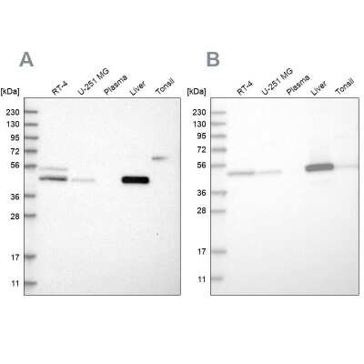 Western Blot: PCYT2 Antibody [NBP1-83952]