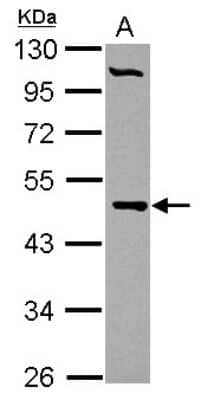 Western Blot: PCYT2 Antibody [NBP2-19735]