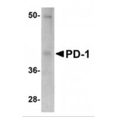 Western Blot: PD-1 Antibody (12A7D7)BSA Free [NBP1-75519]