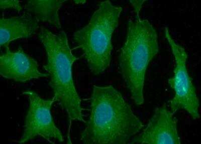 Immunocytochemistry/ Immunofluorescence: PD-1 Antibody (4F12) - BSA Free [NBP1-04328]