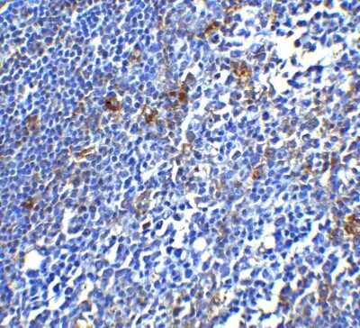 Immunohistochemistry: PD-1 Antibody - BSA Free [NBP1-77276]