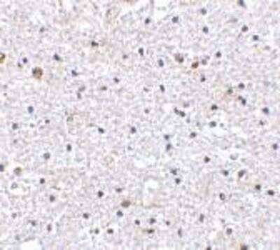 Immunohistochemistry-Paraffin: PD-1 Antibody - BSA Free [NBP1-77276]