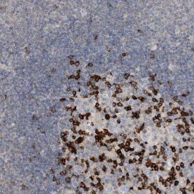 Immunohistochemistry-Paraffin: PD-1 Antibody [NBP1-88104]