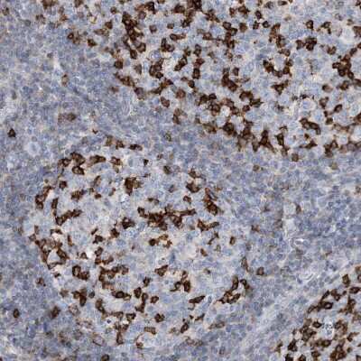 Immunohistochemistry-Paraffin: PD-1 Antibody [NBP1-88104]