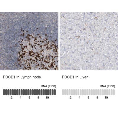 Immunohistochemistry-Paraffin: PD-1 Antibody [NBP1-88104]