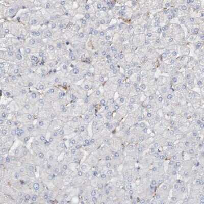Immunohistochemistry-Paraffin: PD-1 Antibody [NBP1-88104]