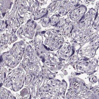 Immunohistochemistry-Paraffin: PD-1 Antibody [NBP1-88104]