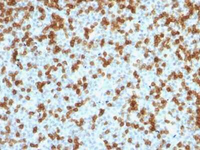 Immunohistochemistry-Paraffin: PD-1 Antibody (PDCD1/1410R) [NBP2-53209]