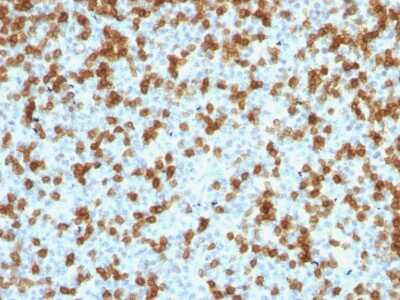 Immunohistochemistry-Paraffin: PD-1 Antibody (PDCD1/1410R) - Azide and BSA Free [NBP2-54570]