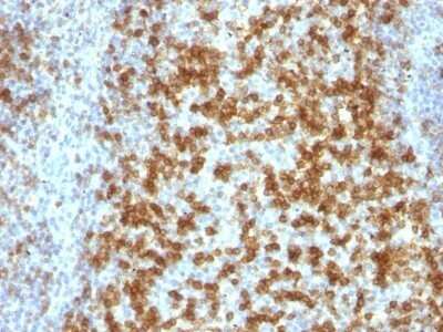 Immunohistochemistry-Paraffin: PD-1 Antibody (PDCD1/922) - Azide and BSA Free [NBP2-47805]