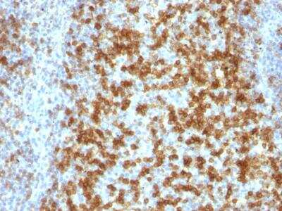 Immunohistochemistry-Paraffin: PD-1 Antibody (PDCD1/922) - IHC-Prediluted [NBP2-48285]