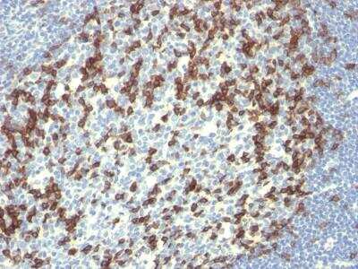 Immunohistochemistry-Paraffin: PD-1 Antibody (PDCD1/922) - IHC-Prediluted [NBP2-48285]