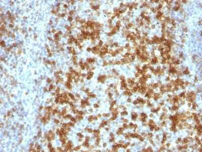 Immunohistochemistry-Paraffin: PD-1 Antibody (PDCD1/922) [NBP2-44398]