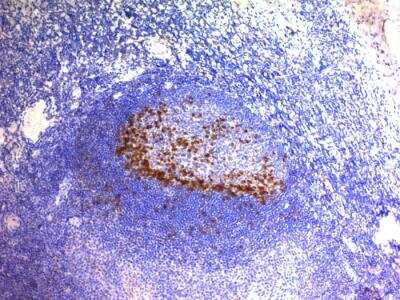 Immunohistochemistry-Paraffin: PD-1 Antibody (SPM597) - IHC-Prediluted [NBP2-48286]