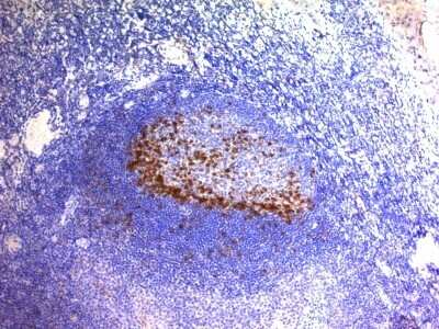 Immunohistochemistry-Paraffin: PD-1 Antibody (SPM597) [NBP2-44399]