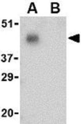 Western Blot: PD-1 AntibodyBSA Free [NBP1-77276]