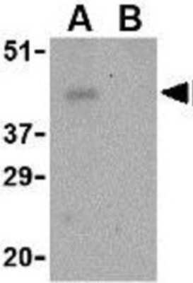 Western Blot: PD-1 AntibodyBSA Free [NBP1-77277]