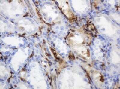 Immunohistochemistry: PD-ECGF/Thymidine Phosphorylase Antibody (OTI7A6) [NBP2-45397]
