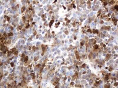 Immunohistochemistry: PD-ECGF/Thymidine Phosphorylase Antibody (OTI7A6) [NBP2-45397]