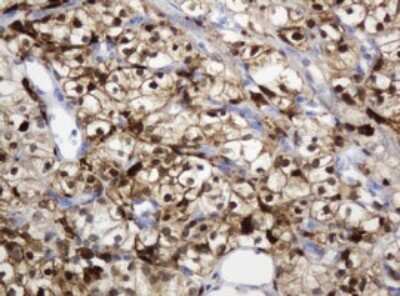 Immunohistochemistry: PD-ECGF/Thymidine Phosphorylase Antibody (OTI7A6) [NBP2-45397]
