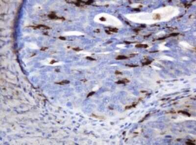 Immunohistochemistry: PD-ECGF/Thymidine Phosphorylase Antibody (OTI7A6) [NBP2-45397]