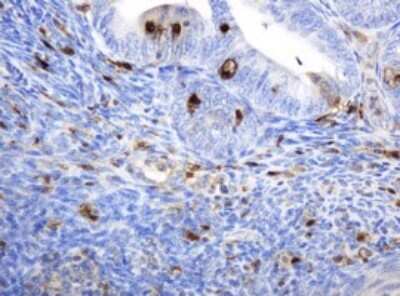 Immunohistochemistry: PD-ECGF/Thymidine Phosphorylase Antibody (OTI7A6) [NBP2-45397]