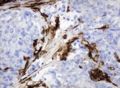 Immunohistochemistry: PD-ECGF/Thymidine Phosphorylase Antibody (OTI7A6) [NBP2-45397]