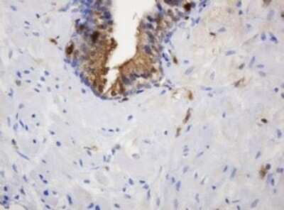 Immunohistochemistry: PD-ECGF/Thymidine Phosphorylase Antibody (OTI7A6) [NBP2-45397]