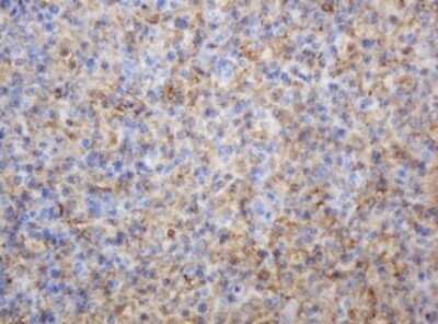Immunohistochemistry: PD-ECGF/Thymidine Phosphorylase Antibody (OTI7A6) [NBP2-45397]