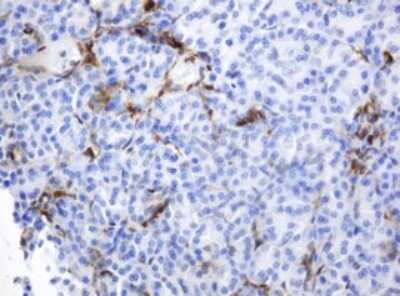 Immunohistochemistry: PD-ECGF/Thymidine Phosphorylase Antibody (OTI7A6) [NBP2-45397]