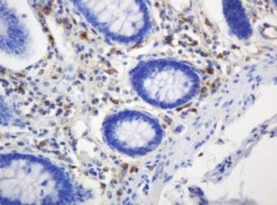 Immunohistochemistry: PD-ECGF/Thymidine Phosphorylase Antibody (OTI7A6) [NBP2-45397]