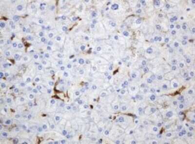 Immunohistochemistry: PD-ECGF/Thymidine Phosphorylase Antibody (OTI7A6) [NBP2-45397]