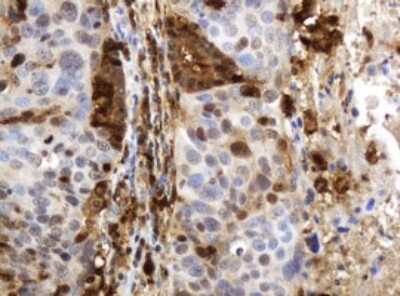 Immunohistochemistry: PD-ECGF/Thymidine Phosphorylase Antibody (OTI7A6) [NBP2-45397]