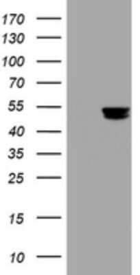 Western Blot: PD-ECGF/Thymidine Phosphorylase Antibody (OTI7A6) [NBP2-45397]