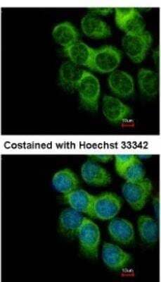 Immunocytochemistry/ Immunofluorescence: PD-ECGF/Thymidine Phosphorylase Antibody [NBP1-31458]