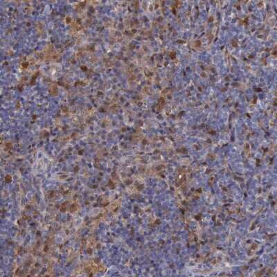 Immunohistochemistry-Paraffin: PD-ECGF/Thymidine Phosphorylase Antibody [NBP1-84916]