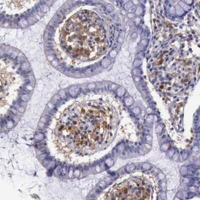 Immunohistochemistry-Paraffin: PD-ECGF/Thymidine Phosphorylase Antibody [NBP1-84916]